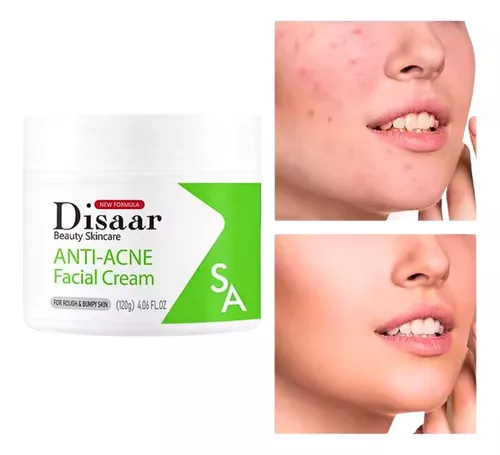 acne verde 66.webp acne verde 66.webp