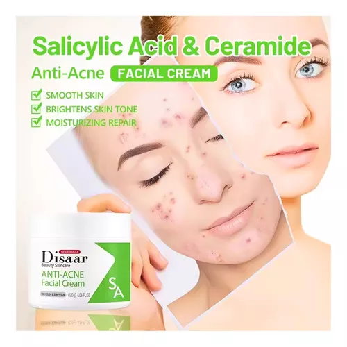 crema facial anti acné disaar anti inflamatorio repar crema facial anti acné disaar anti inflamatorio repar