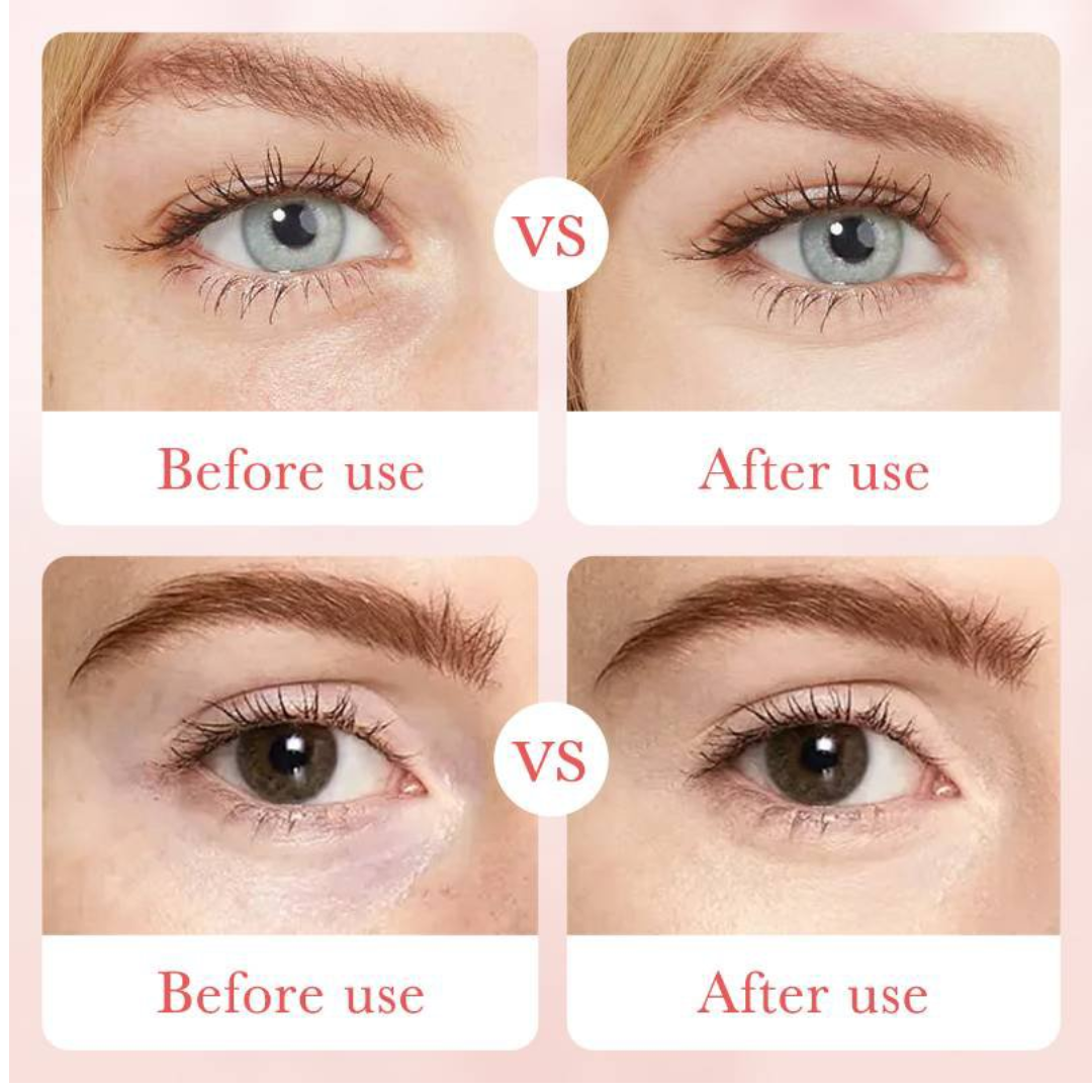 contorno de ojos rose acido hialuronico contorno de ojos rose acido hialuronico