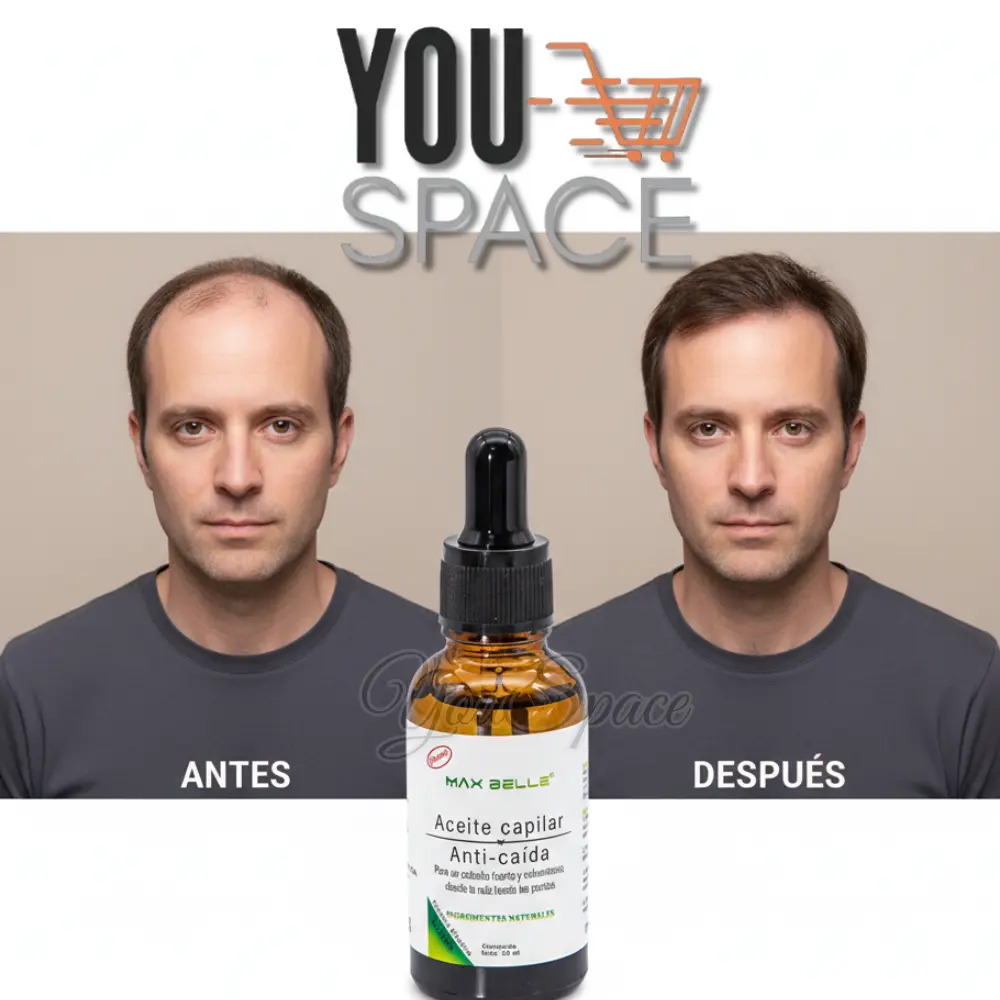 serum anticaida natural crecimiento de cabello max belle serum anticaida natural crecimiento de cabello max belle