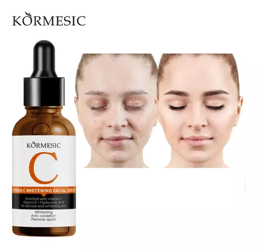 serum facial de vitamina c kormesic aclarante serum facial de vitamina c kormesic aclarante